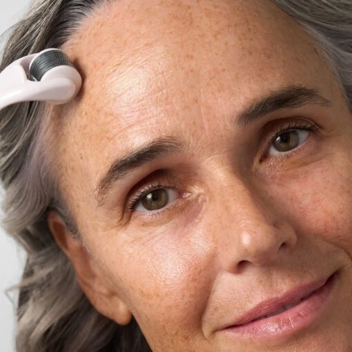 Slowpoke Microneedling Facial Roller - Image 4